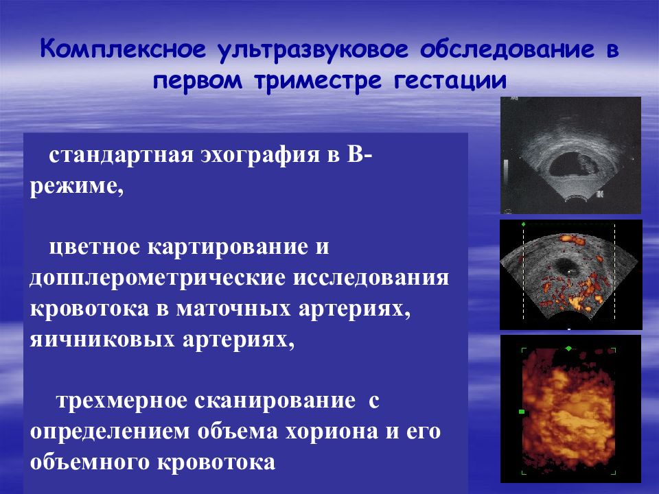 Многоплодная беременность презентация