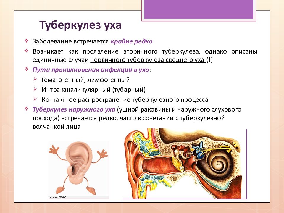 Туберкулез лор органов презентация