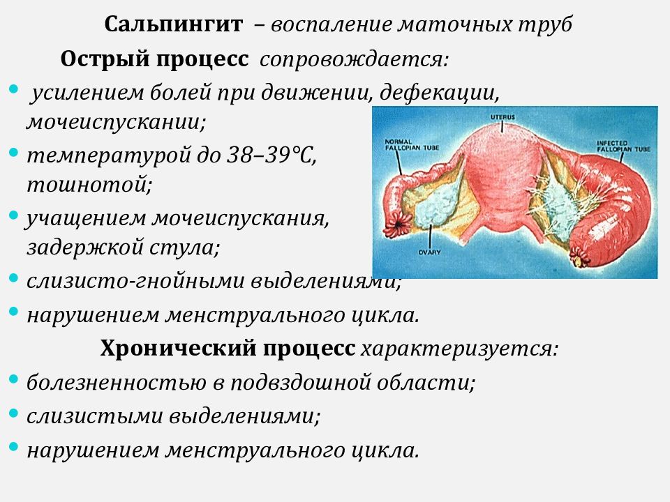 Схема лечения гидросальпинкса