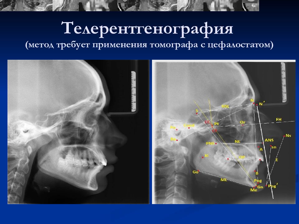 Рентгенодиагностика в стоматологии презентация