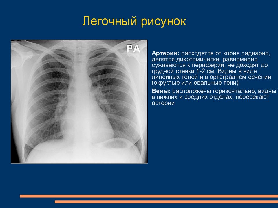 Корни тяжистые легких рисунок изменен