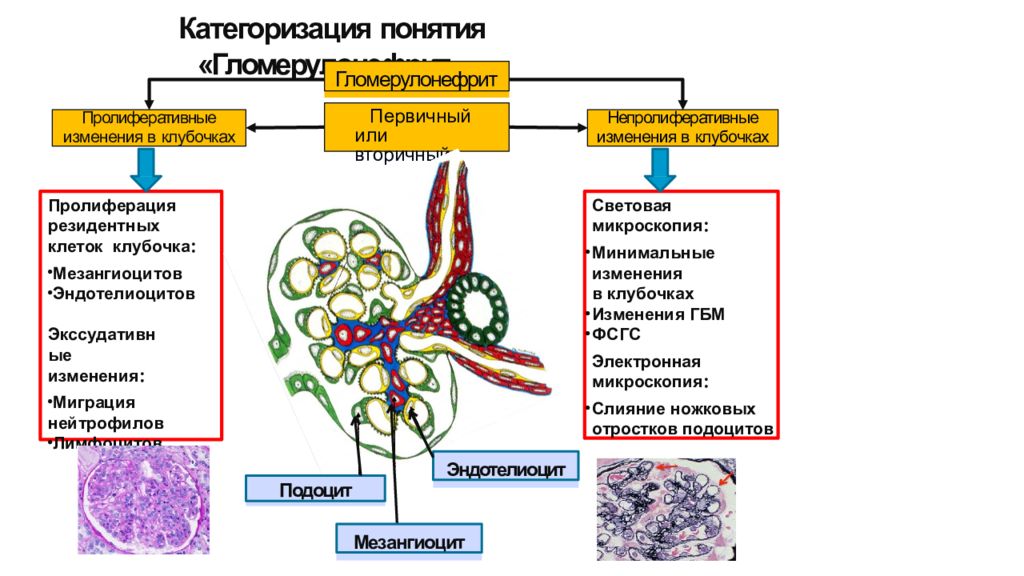 Презентация на тему гломерулонефрит