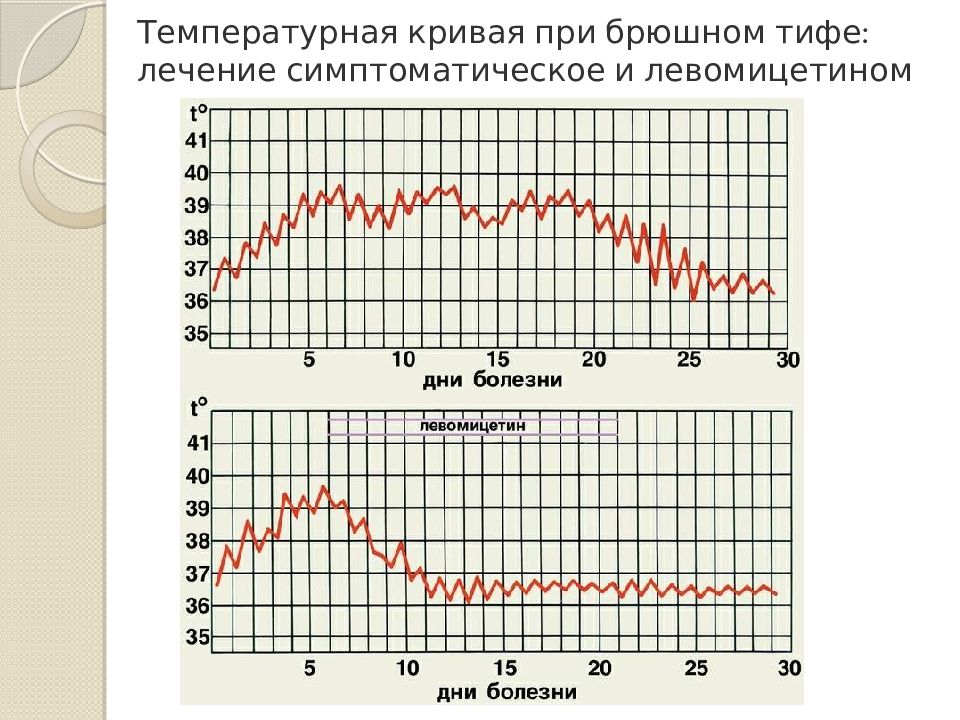 Ятрогенная перфорация при брюшном тифе. Перфорация брюшнотифозной язвы. Ятрогенная перфорация при брюшном тифе. Брюшной тиф стадия образования язв. Ятрогенная перфорация при брюшном тифе.