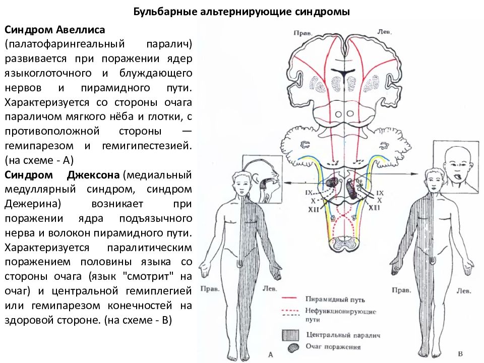 Неврология в картинках и схемах