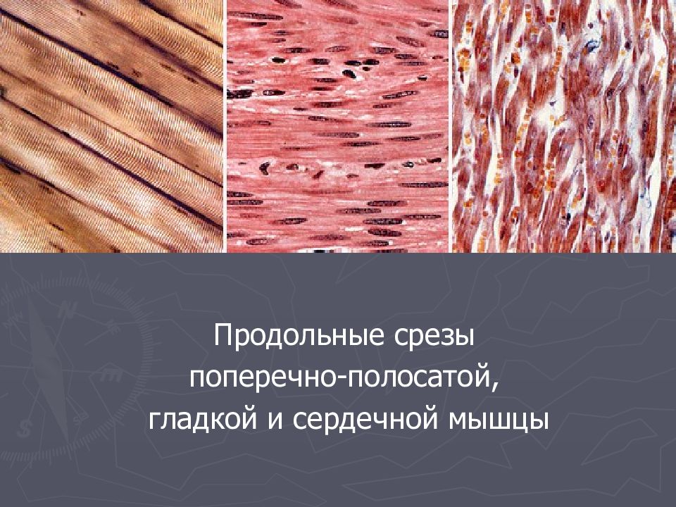 Мышечная ткань поперечно полосатая гладкая сердечная. Продольный срез поперечно полосатой мышечной ткани. Гладкая мышечная ткань продольный срез. Продольный срез мышечной ткани. Доброкачественная опухоль из поперечно-полосатой мышечной ткани.