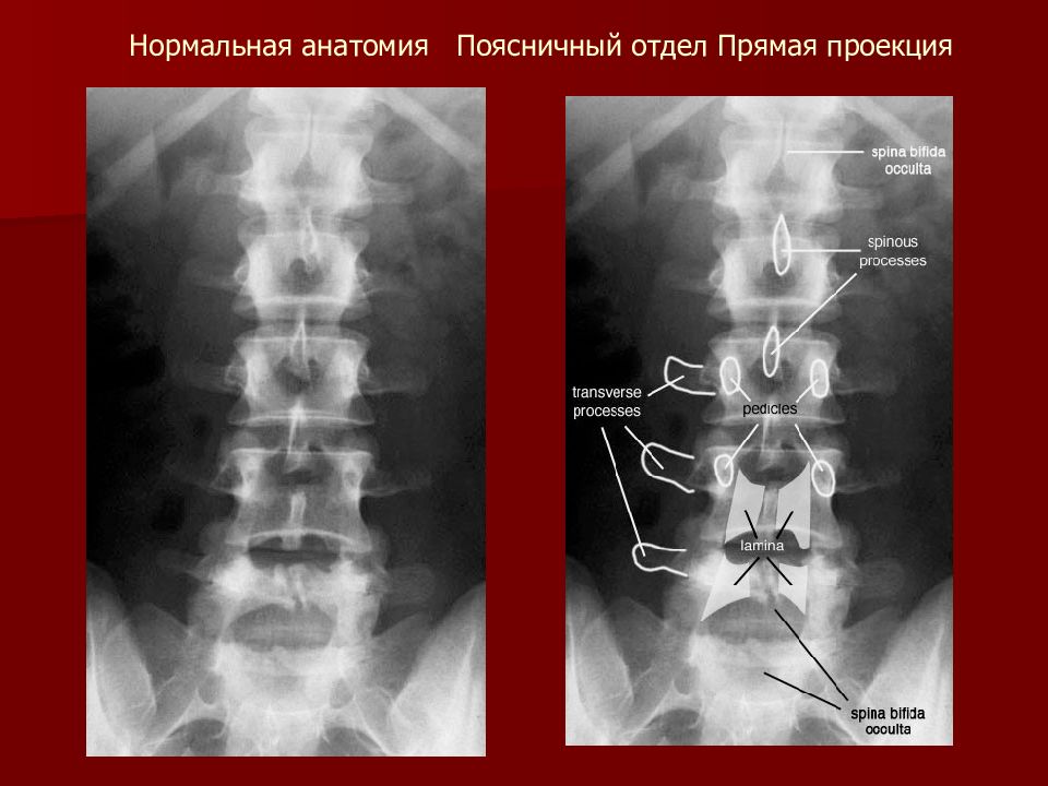 Анатомия поясничного отдела позвоночника презентация