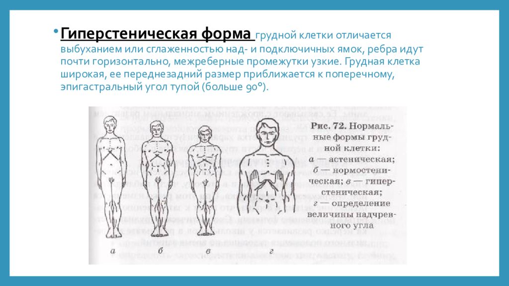 Площадь поверхности грудной клетки у человека. Астеническая гиперстеническая и нормостеническая грудная клетка. Нормостенический Тип грудной клетки. Форма грудной клетки астеническая угол. Формы грудной клетки нормостеническая астеническая.