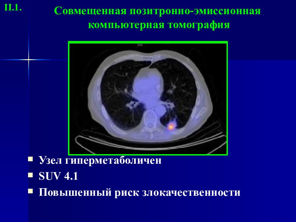 Лучевая диагностика нервной системы презентация