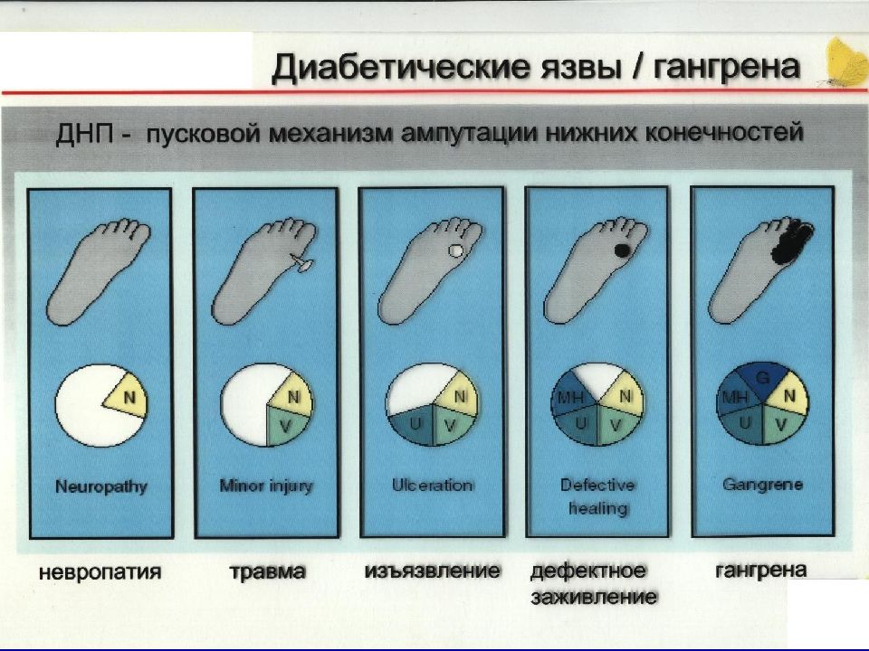 Гангрена нижней конечности карта вызова скорой помощи