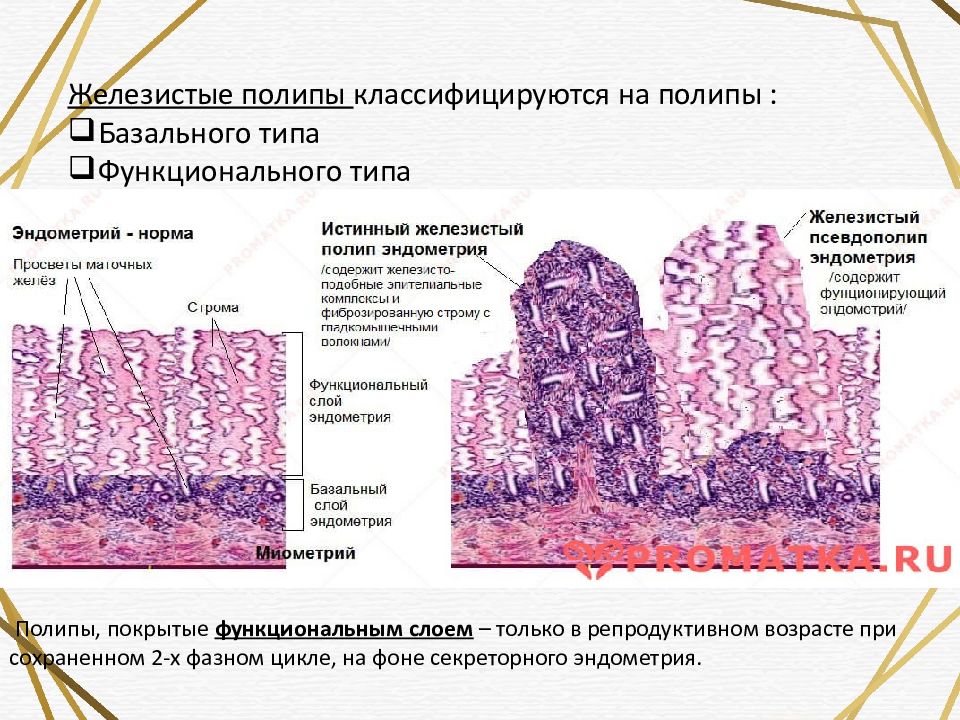 Выраженный сосудистый рисунок эндометрия