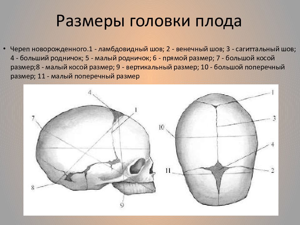 Стреловидный родничок. Размеры головки плода. Размеры черепа новорожденного. Малый косой размер головки. Прямой размер головки.