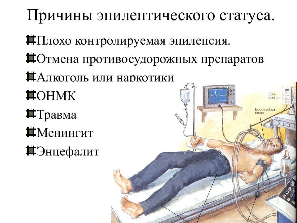 Презентация на тему эпилепсия