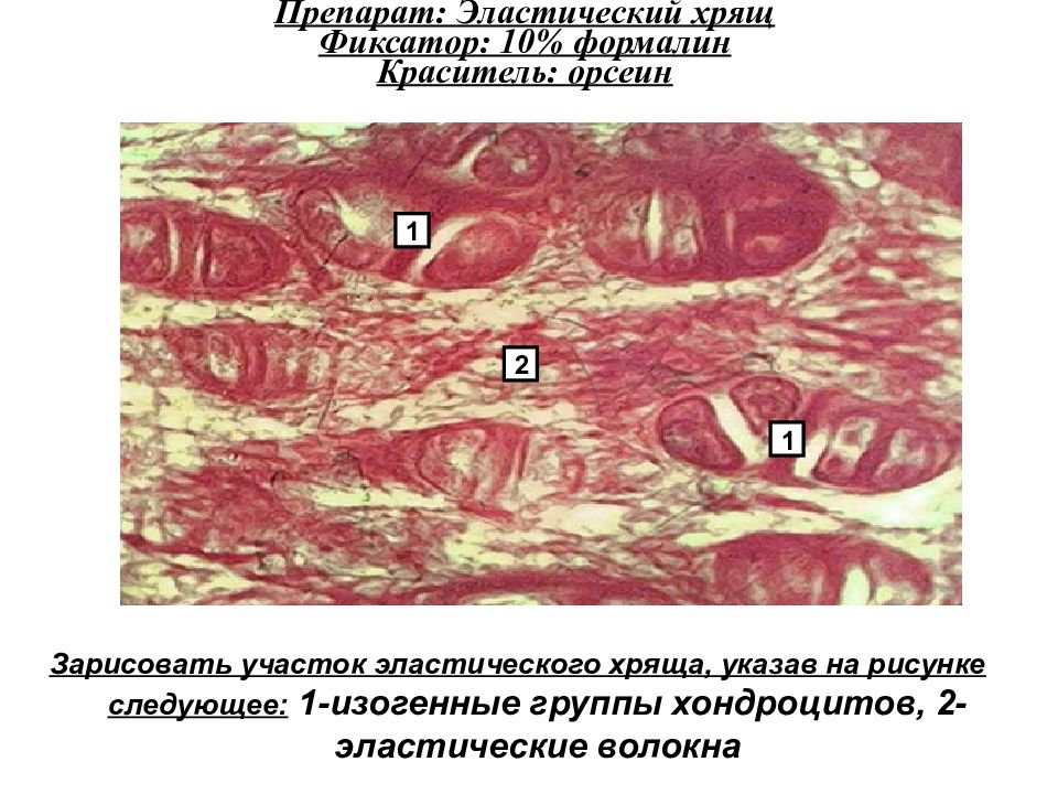 Изогенные группы. Изогенные группы хондроцитов. Скелетная соединительная ткань. Изогенные группы эластического хряща. Скелетные соединительные ткани гистология.