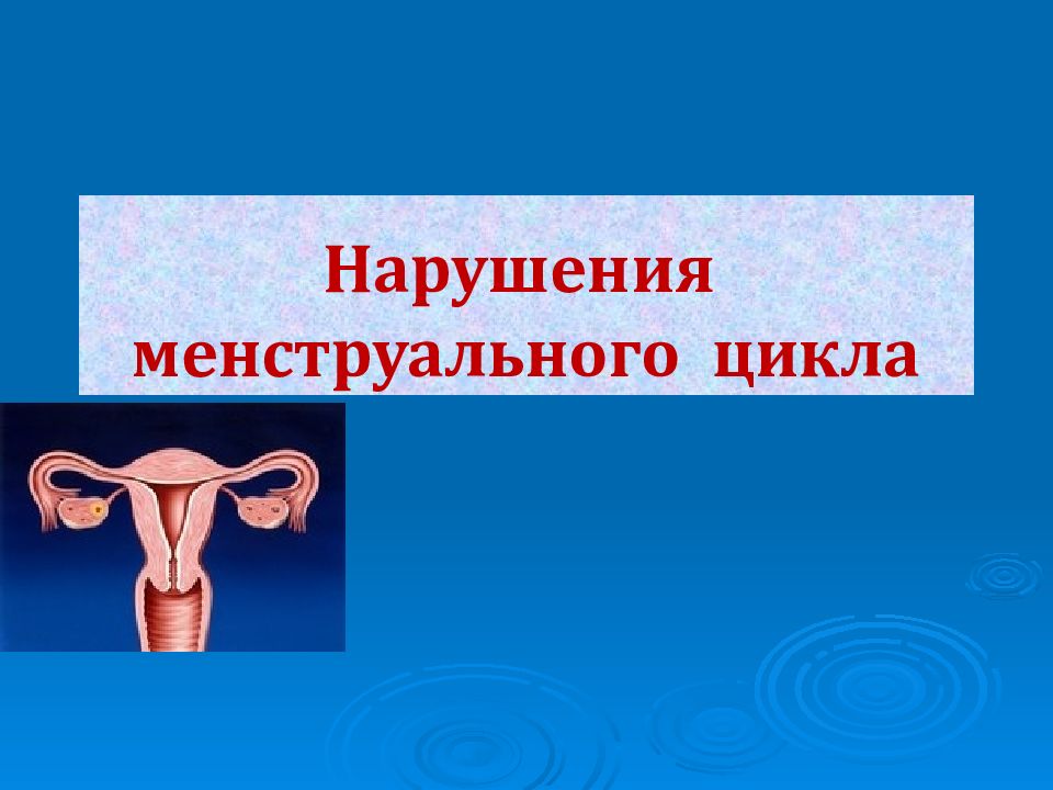 Презентация нарушения менструационного цикла