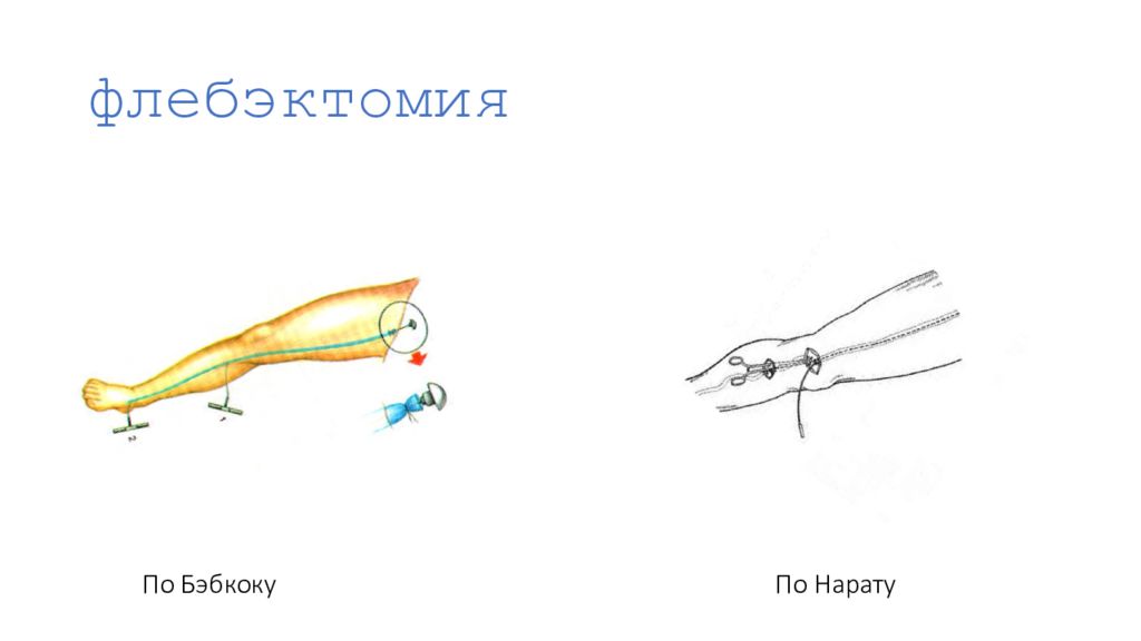 Операция троянова