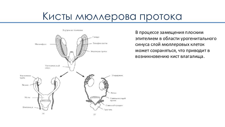 Парауретральная железа у женщин