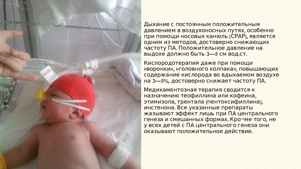 Новорожденный тяжело дышит. СРАР аппарат для новорожденных. Назальные канюли для новорожденных. Носовой канюля для недоношенных.