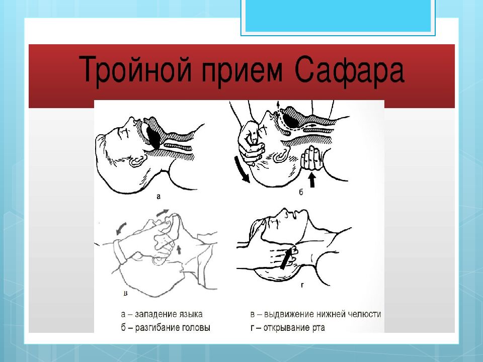 Тақырыбы:Жүрек-өкпе реанимациясы.Мәйітпен жұмыс жасау ережелері