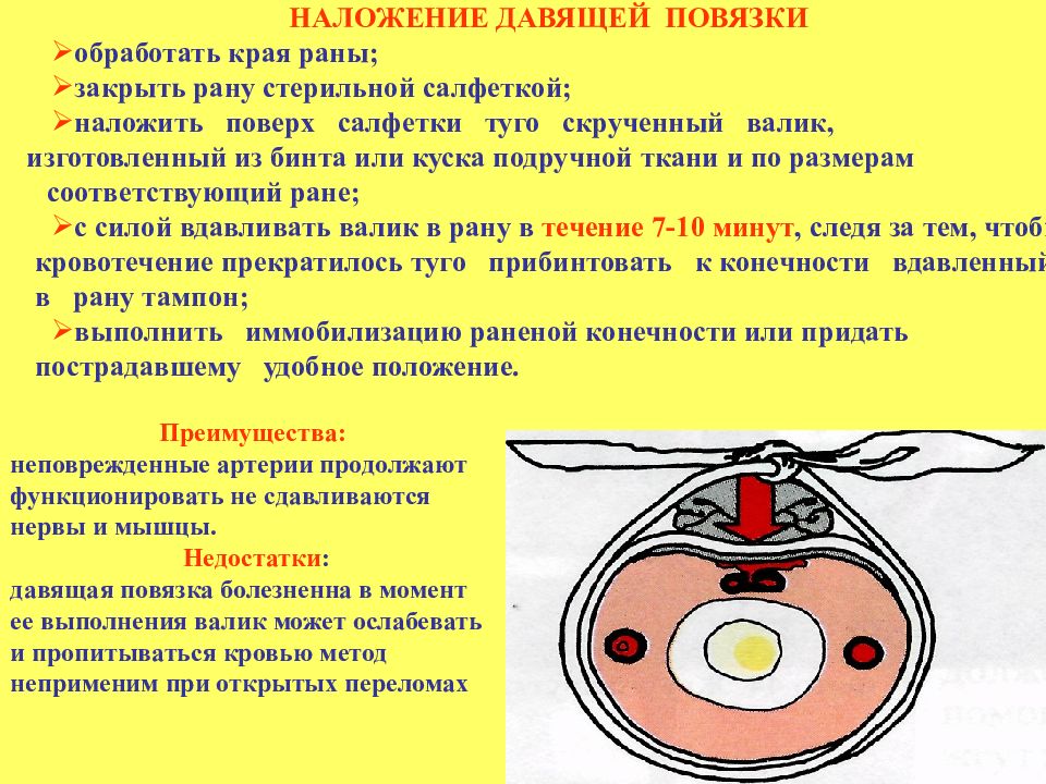 Давящие сроки. Наложение давящей повязки достоинства и недостатки. Наложение давящей повязки механизм действия. Наложение давящей повязки осложнения. Наложение давящей повязки механизм действия достоинства недостатки.