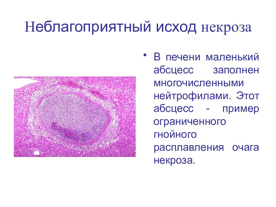 Блок схема исходы некроза