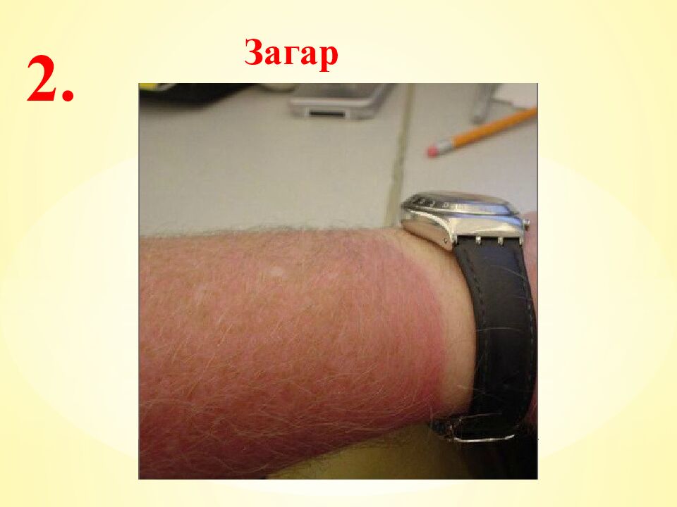 Экспресс-тест 1-й вариант 1. Случайное расхождение гомологичных хромосом при