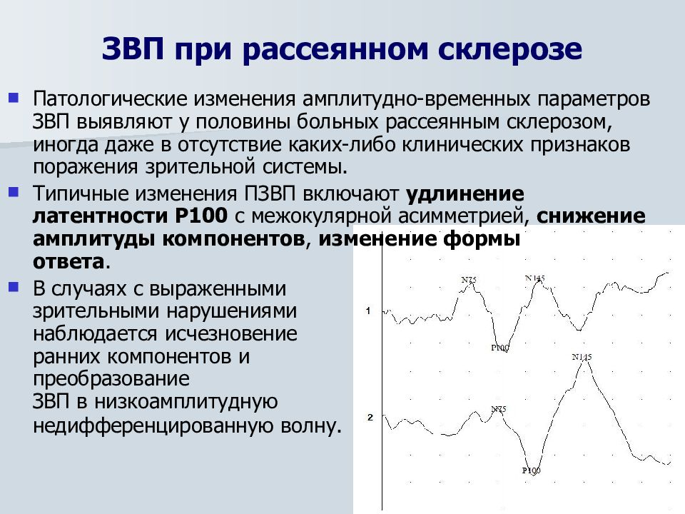 Зрительные вызванные потенциалы