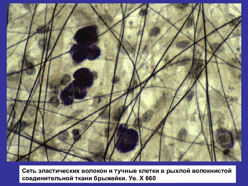 Рыхлая волокнистая соединительная ткань волокна. Гистология ткань рыхлая соединительная ткань. РВСТ гистология препарат. Рыхлая соединительная ткань препарат. Тучные клетки в рыхлой соединительной ткани.