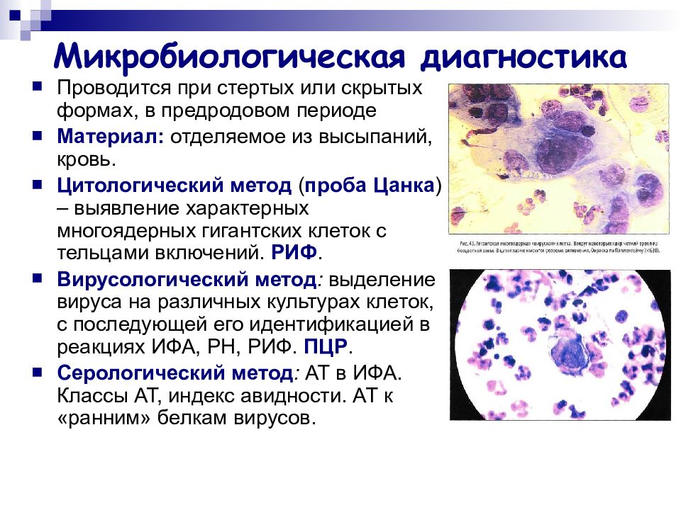 Презентация на тему герпес вирус