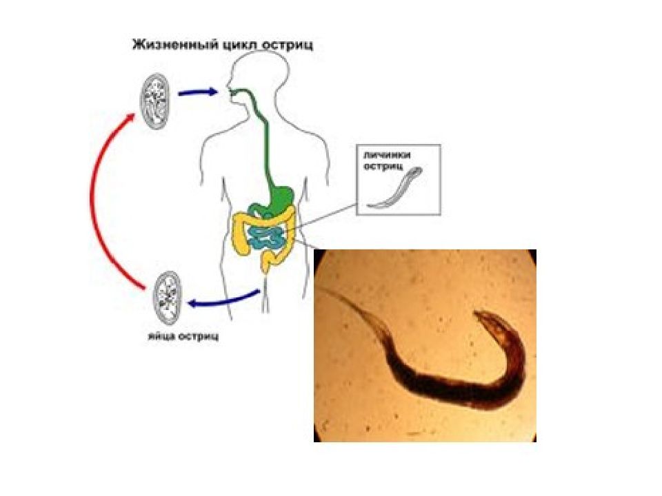 Острица и аскарида фото