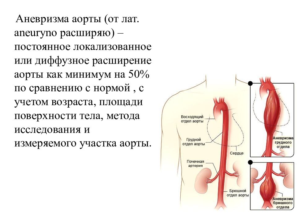 Что такое аорта