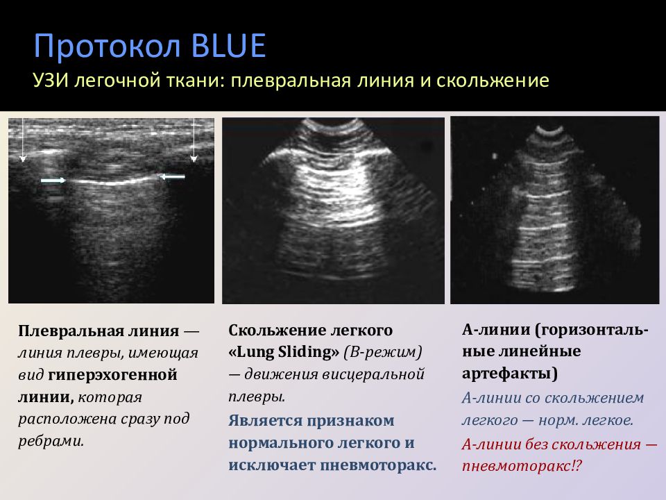 Изображение при узи получают