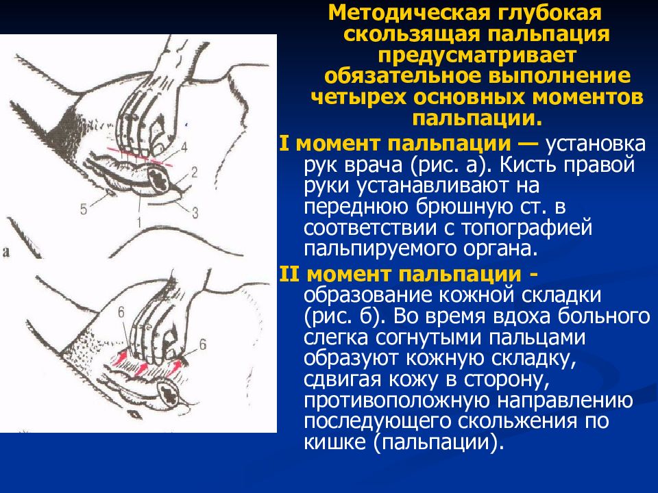 4 нарисовать топографическое расположение отделов толстого кишечника при глубокой пальпации живота