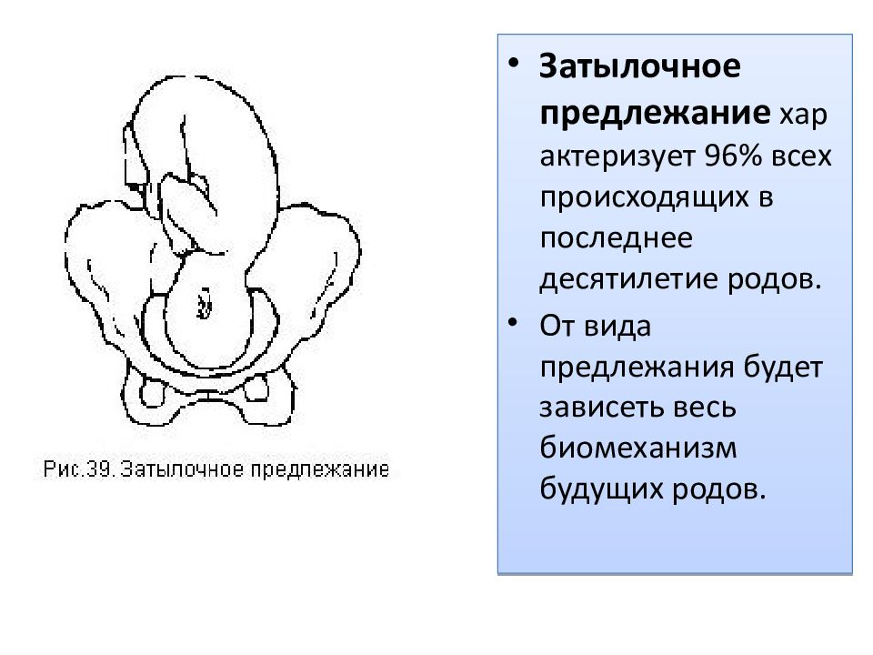 Биомеханизм родов при затылочном вставлении