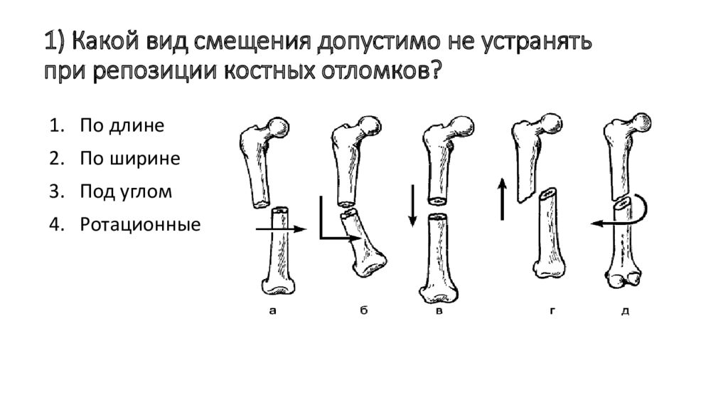 Смещение отломков кости. Основные типы смещения костных отломков. Типы смещения костных отломков при переломах. Смещение костных отломков по длине и ширине. Поперечный перелом со смещением отломков по ширине.