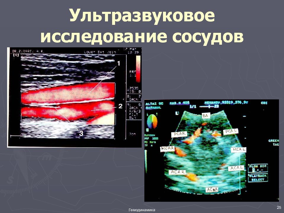 Узи сосудов. УЗИ исследование сосудов. Исследование кровотока сосудов. Исследование сосудов ПВБ.