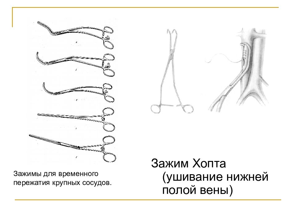 Соединение тканей. Зажим венозный. Зажим для вен. Зажатие нижней полой вены. Турникеты для временного пережатия сосудов.