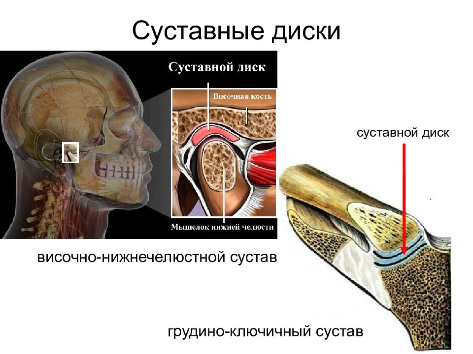 Суставной диск. Суставной диск грудино ключичного сустава. Суставной диск височно-нижнечелюстного сустава. Суставной диск расположен.