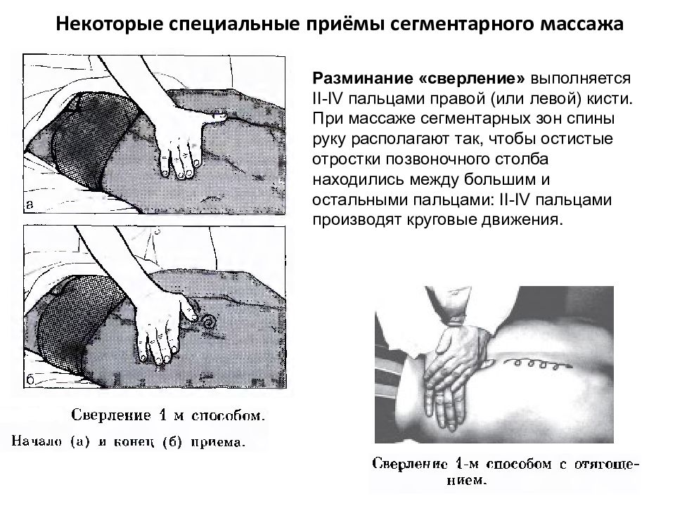 Специальные приемы. Приемы сегментарно рефлекторного массажа. Прием сверление в массаже. Прием сверление в сегментарном массаже. Перечислите приемы сегментарного массажа.