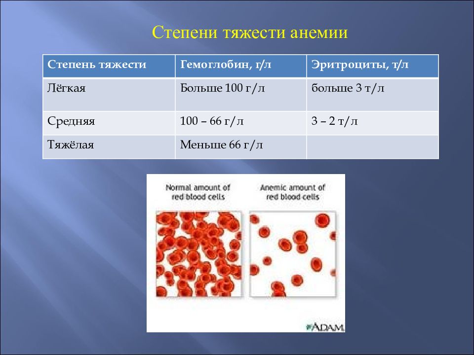Показатели гемоглобина при анемии. Анемия классификация степени. Гемоглобин классификация анемии. Анемия 3 степени гемоглобин. Степени тяжести анемии по гемоглобину у женщин.