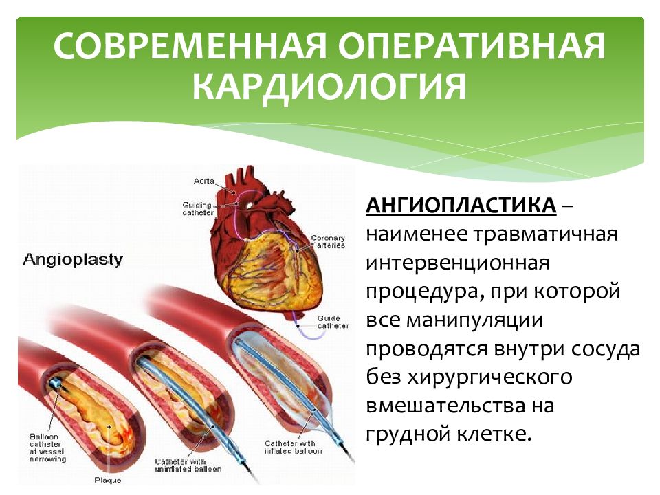 Презентация по теме сердечно сосудистые заболевания