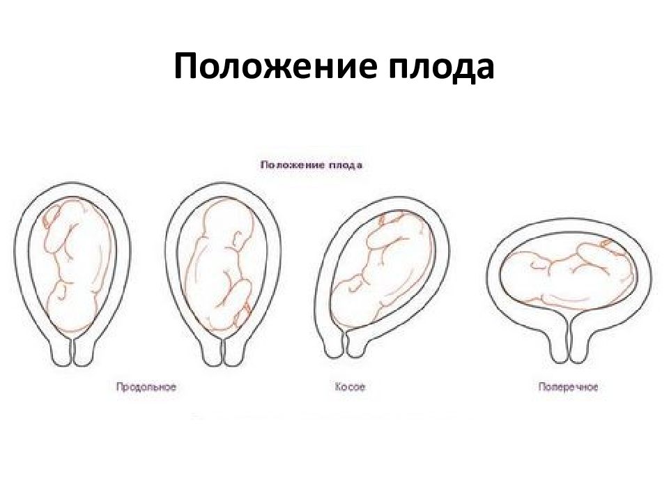 1 позиция плода передний вид. Передний вид плода. Неправильное положение плода. Вид позиции плода. Вторая позиция задний вид плода.