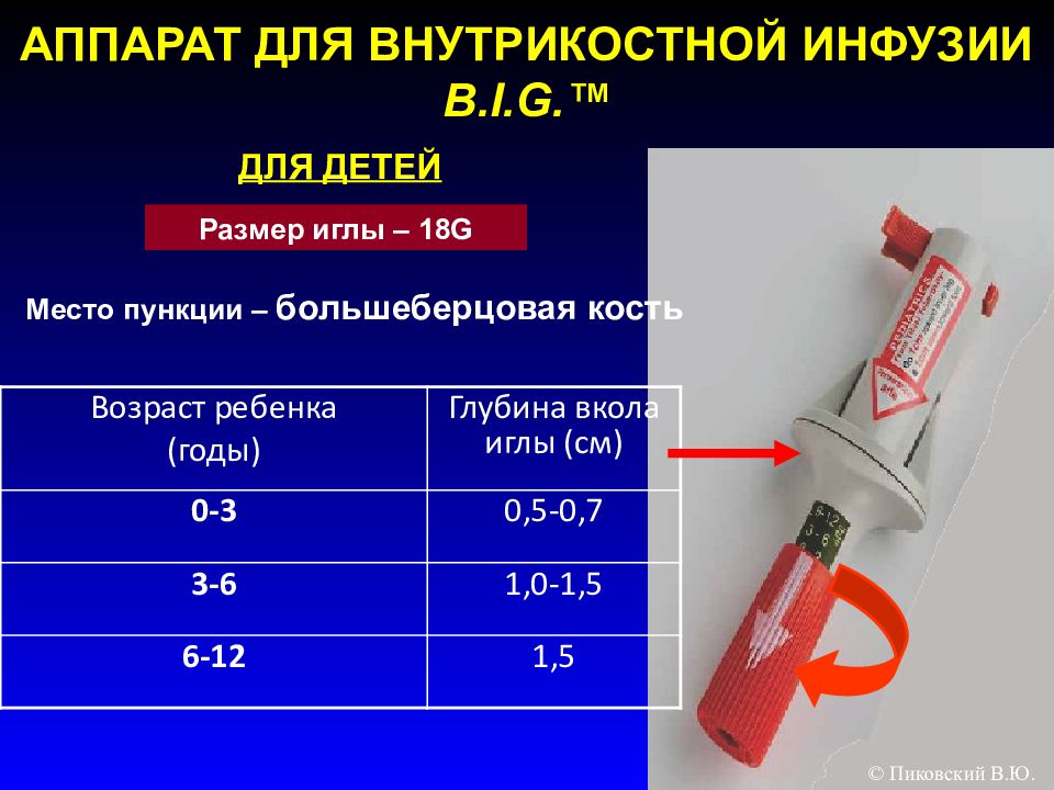 Инфузия детям. Прибор инфузионный внутрикостный b.i.g. Adult (Blue 15g). Прибор для внутрикостного доступа. Система для внутрикостного вливания. Внутрикостная инфузия.