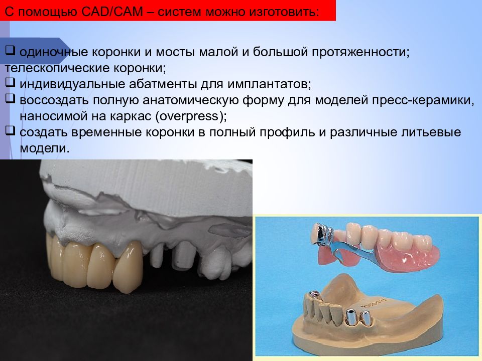 Коронки ортопедическая стоматология презентация