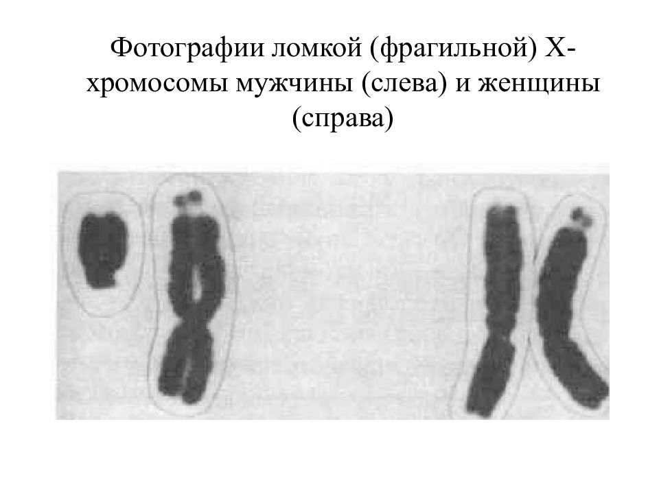 Х и у хромосомы у мужчин. Мужские хромосомы. X Y хромосомы мужские и женские. Хромосомы у мужчин и женщин. ХХ хромосомы у кого.