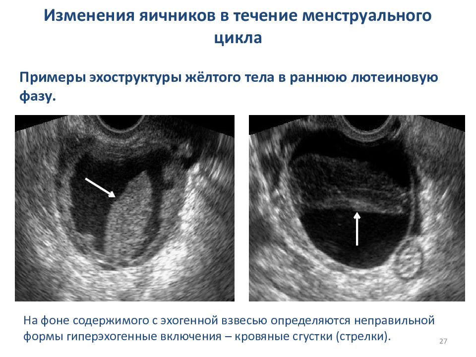 Узи кисты яичника на какой день. Фазы менструального цикла на УЗИ. УЗИ 2 фазы менструационного цикла.