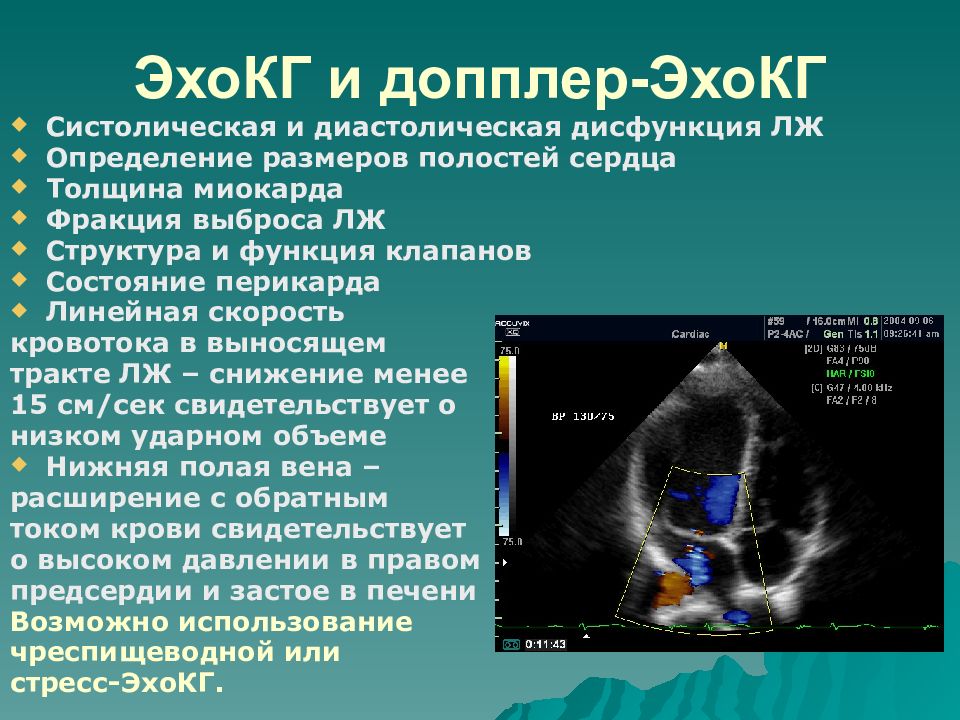 Стресс эхо кг презентация