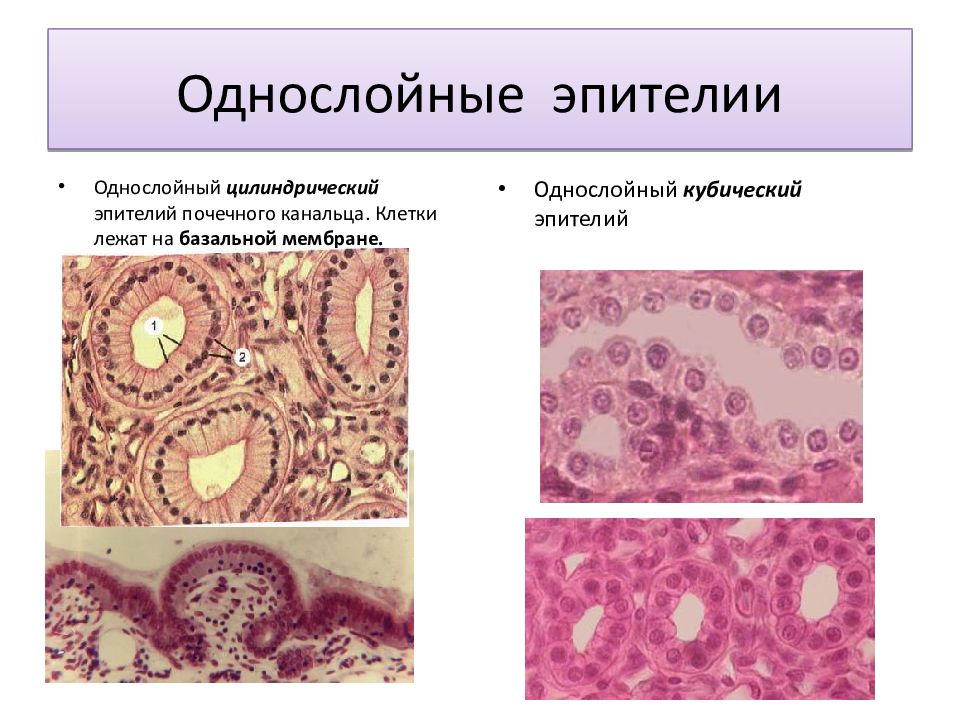 Клетки лежала. Однослойный кубический эпителий канальцев почки. Однослойный цилиндрический эпителий почечного канальца. Однослойный кубический и цилиндрический эпителий почечных канальцев. Базальная мембрана в однослойном кубическом эпителии.