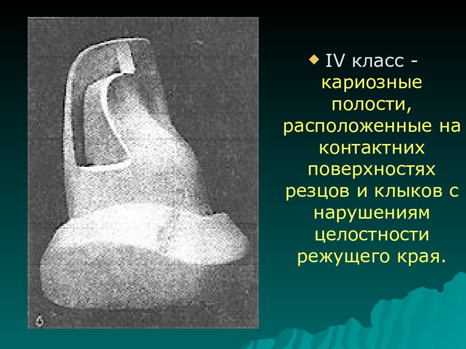 4 класс по блэку презентация