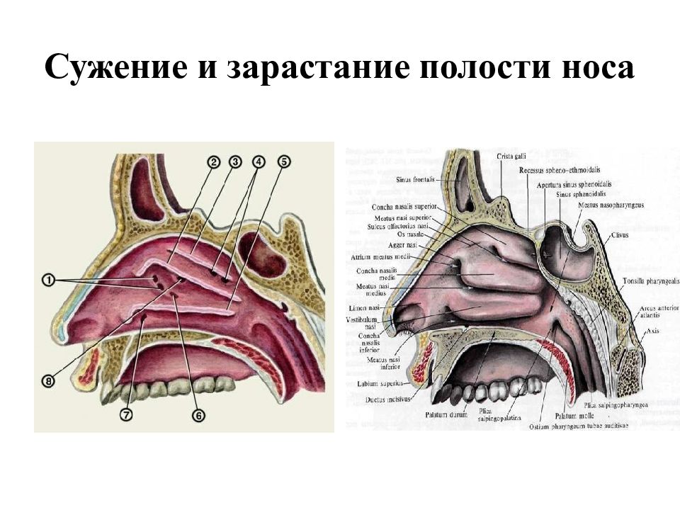 Анатомия органов слуха речи и зрения. Органы полости носа. Аномалии носовой полости. Полость носа таблица. В полости носа выделяют.