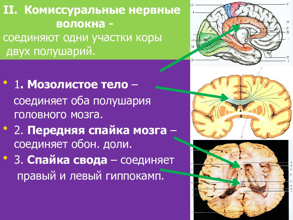 Проводящие системы головного мозга. Ассоциативные комиссуральные и проекционные волокна. Комиссуральные волокна конечного мозга. Комиссуральные волокна мозолистого тела. Нервные волокна ассоциативные комиссуральные и проекционные.